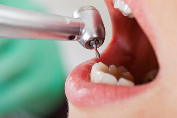 Best Emergency Root Canal Therapy in Ritzville, WA